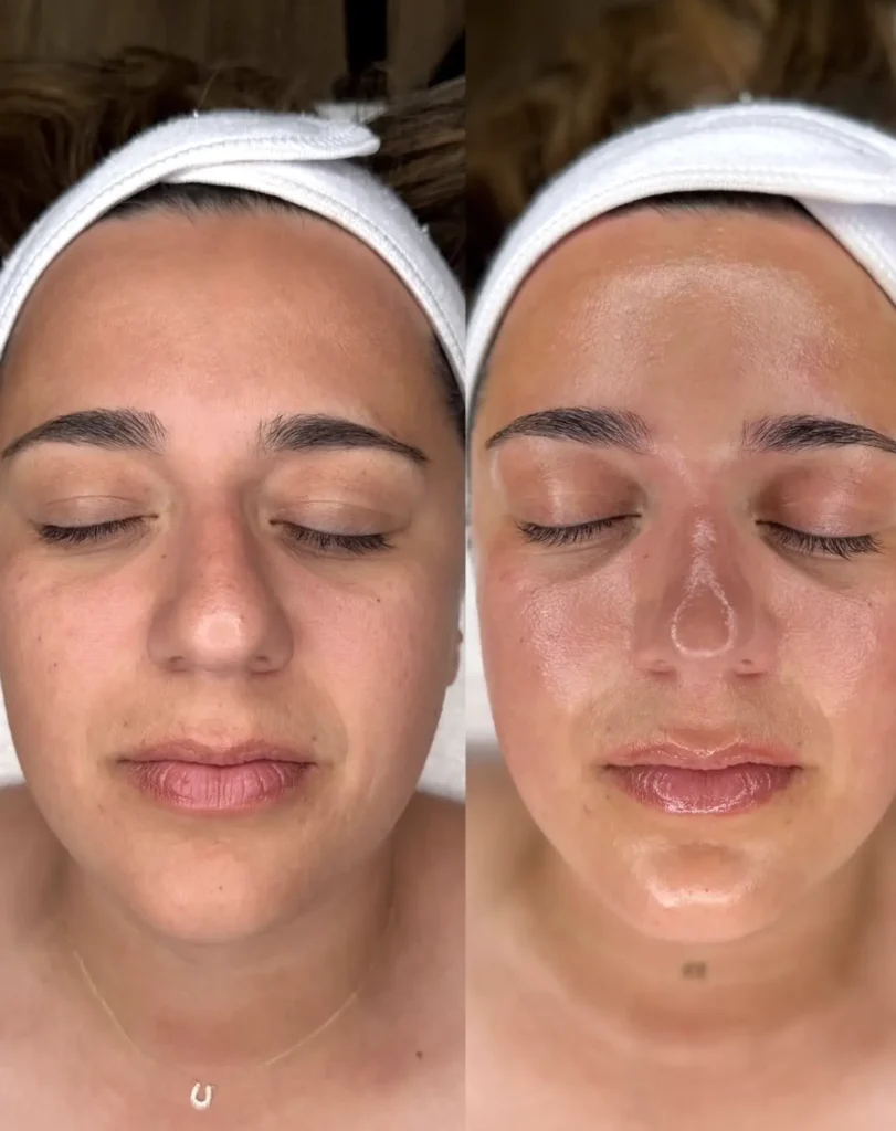 Why Brisbane Skin Needs Extra Hydration