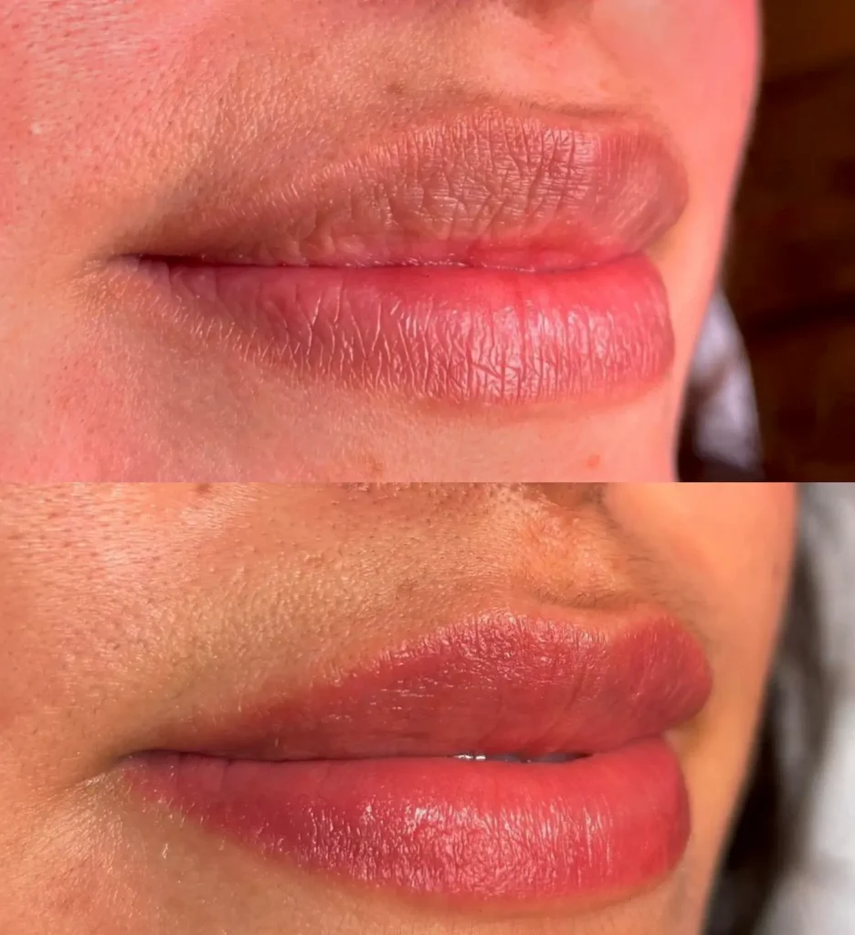cosmetic tattooing