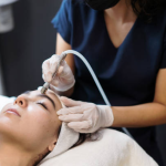 All Sesame|Optimal Microdermabrasion Session Count for Clear Skin Results