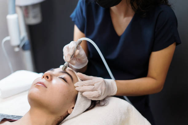 All Sesame|Optimal Microdermabrasion Session Count for Clear Skin Results